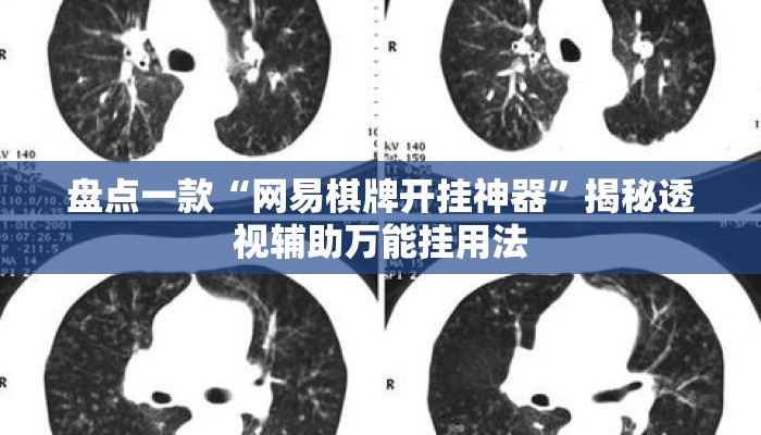 盘点一款“网易棋牌开挂神器”揭秘透视辅助万能挂用法