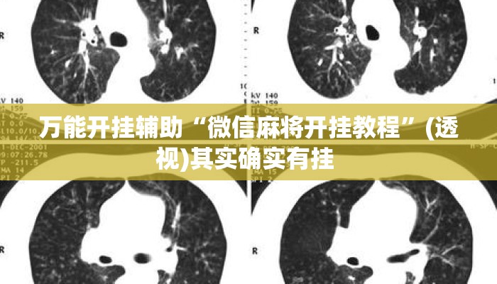 万能开挂辅助“微信麻将开挂教程”(透视)其实确实有挂 